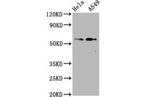 Western Blot Positive WB detected in Hela whole cell lysate,A549 whole cell lysate All lanes Phospho-SMAD2 antibody at 1. (Recombinant SMAD2 antibody  (pSer250))