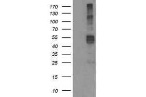 Western Blotting (WB) image for anti-Transmembrane Protease, serine 5 (TMPRSS5) antibody (ABIN1501445) (TMPRSS5 antibody)