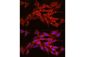 Immunofluorescence analysis of NIH/3T3 cells using SEC61 Rabbit pAb (1614) at dilution of 1:350 (40x lens).