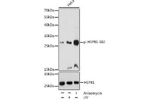 Western blot analysis of extracts of HeLa cells using Phospho-HSPB1(S82) Polyclonal Antibody at dilution of 1:1000. (HSP27 antibody  (pSer82))