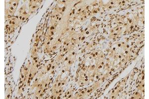 ABIN6277572 at 1/100 staining Human kidney tissue by IHC-P. (NDC80 antibody  (C-Term))