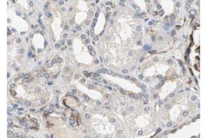 ABIN6277788 at 1/100 staining Human kidney tissue by IHC-P. (RAB10 antibody  (C-Term))