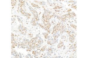 Immunohistochemistry (IHC) image for anti-Cullin 4A (CUL4A) (C-Term) antibody (ABIN7453591)