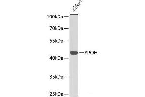 Western blot analysis of extracts of 22Rv1 cells using APOH Polyclonal Antibody at dilution of 1:1000. (APOH antibody)