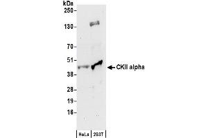 Western Blotting (WB) image for anti-Casein Kinase 2 alpha 1 (CSNK2A1) (AA 1-50) antibody (ABIN7452878)