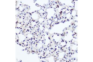 Immunohistochemistry of paraffin-embedded rat lung using NFIA Rabbit pAb (ABIN1681040, ABIN3017626, ABIN3017627 and ABIN6220178) at dilution of 1:200 (40x lens).