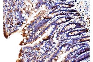 IHC analysis of MLX-interacting protein/MLXIP using anti-MLX-interacting protein/MLXIP antibody (ABIN7602593). (MLXIP antibody  (AA 88-348))