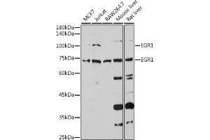 Western blot analysis of extracts of various cell lines, using EGR1 antibody (ABIN3016527, ABIN3016528, ABIN3016529 and ABIN1679679) at 1:1000 dilution. (EGR1 antibody)