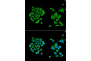 Immunofluorescence analysis of MCF-7 cells using DDX58 antibody (ABIN5970201). (DDX58 antibody)