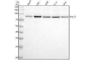Western blot analysis of MALT1 using anti-MALT1 antibody (ABIN7605482).