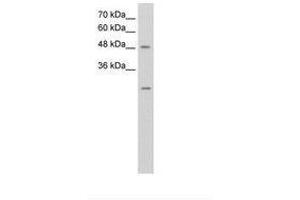 Image no. 1 for anti-Ankyrin Repeat Domain 2 (Stretch Responsive Muscle) (ANKRD2) (AA 51-100) antibody (ABIN6736641) (ANKRD2 antibody  (AA 51-100))