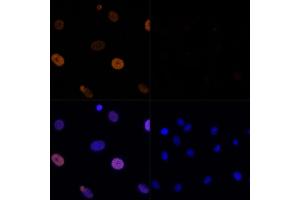 Immunofluorescence analysis of C6 cells using Acetyl-Histone H3-K56 Rabbit pAb (ABIN7267674) at dilution of 100 (40x lens). (Histone 3 antibody  (H3K56))