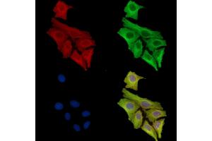 ABIN7097103 and ABIN7101170 staining Hela cells by IF/ICC. (Dolichol Kinase antibody)