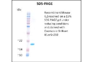 SDS-PAGE (SDS) image for Interleukin 2 (IL2) (Active) protein (ABIN5509345)