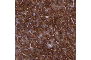 Immunohistochemical staining of human pancreas with USP51 polyclonal antibody  shows strong cytoplasmic positivity in exocrine glandular cells at 1:50-1:200 dilution. (USP51 antibody)