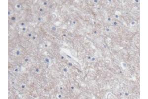 IHC-P analysis of Human Cerebrum Tissue, with DAB staining. (S100B antibody  (AA 1-92))