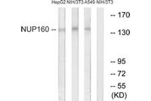 Western blot analysis of extracts from NIH-3T3/A549/HepG2 cells, using NUP160 Antibody.
