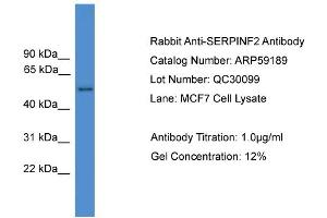 WB Suggested Anti-SERPINF2  Antibody Titration: 0. (alpha 2 Antiplasmin antibody  (N-Term))