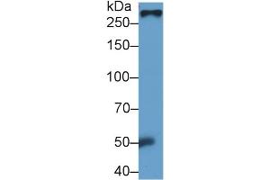 Detection of FN in Rat Serum using Monoclonal Antibody to Fibronectin (FN) (Fibronectin antibody  (AA 355-558))