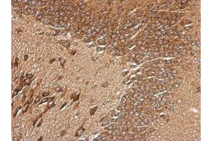 IHC-P Image Immunohistochemical analysis of paraffin-embedded CL1-5 xenograft, using RPL29, antibody at 1:500 dilution.