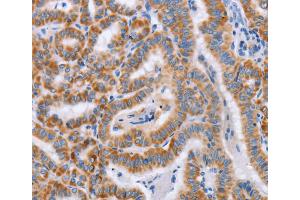 Immunohistochemistry (IHC) image for anti-Bone Marrow Stromal Cell Antigen 1 (BST1) antibody (ABIN2434360)