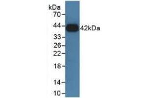 Western blot analysis of recombinant Rat GHR. (Growth Hormone Receptor antibody  (AA 353-588))
