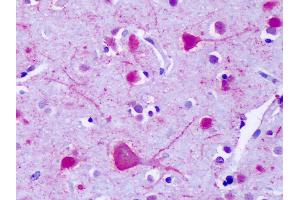 Anti-GPR75 antibody IHC of human brain, cortex, neurons. (GPR75 antibody  (C-Term))