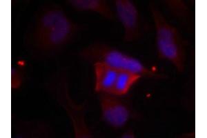 Immunofluorescence staining of methanol-fixed Hela cells using DARPP-32(Phospho-Thr75) Antibody. (DARPP32 antibody  (pThr75))