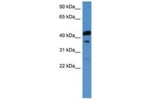 Image no. 1 for anti-Calcitonin Receptor (CALCR) (C-Term) antibody (ABIN6746629) (Calcitonin Receptor antibody  (C-Term))