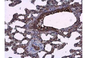 IHC-P Image AGR3 antibody detects AGR3 protein at cytoplasm in rat lung by immunohistochemical analysis. (AGR3 antibody  (Center))