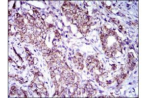 Immunohistochemistry (IHC) image for anti-Activated Leukocyte Cell Adhesion Molecule (ALCAM) (AA 48-216) antibody (ABIN1846222) (CD166 antibody  (AA 48-216))