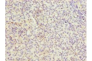 Immunohistochemistry of paraffin-embedded human spleen tissue using ABIN7156460 at dilution of 1:100 (ITGAL antibody  (AA 201-500))