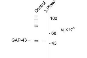 Image no. 2 for anti-Growth Associated Protein 43 (GAP43) (pSer41) antibody (ABIN227321) (GAP43 antibody  (pSer41))