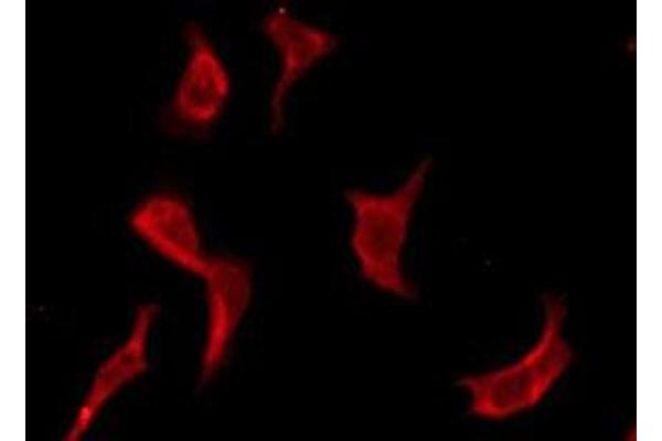 OR13F1 antibody