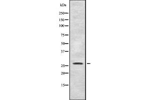Western blot analysis of SYF2 expression in Mouse liver lysate,The lane on the left is treated with the antigen-specific peptide. (SYF2 antibody  (C-Term))