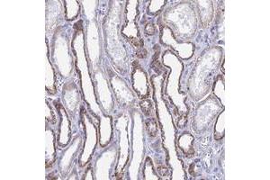 Immunohistochemical staining of human kidney with ACSM1 polyclonal antibody  shows strong cytoplasmic positivity in cells in tubules at 1:20-1:50 dilution.