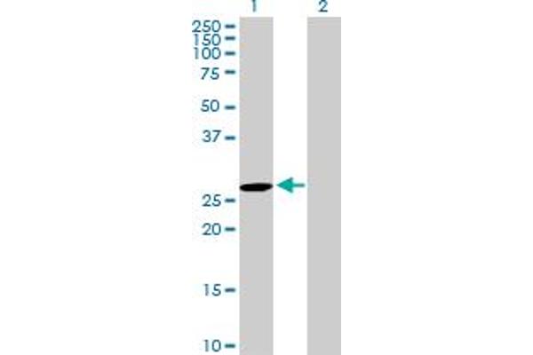 DUPD1 antibody  (AA 1-220)