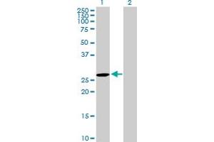 Western Blot analysis of DUPD1 expression in transfected 293T cell line by DUPD1 MaxPab polyclonal antibody. (DUPD1 antibody  (AA 1-220))