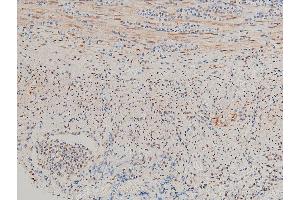 ABIN6267554 at 1/100 staining rat appendiceal tissue sections by IHC-P.