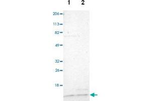 Western blot analysis of Lane 1: Human cell line RT-4, Lane 2: Human cell line U-251MG sp with TIMM9 polyclonal antibody  at 1:100-1:250 dilution. (TIMM9 antibody)