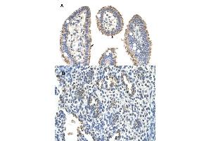 Immunohistochemical staining (Formalin-fixed paraffin-embedded sections) of (A) human intestine and (B) human lung tissues with KRT2 polyclonal antibody . (Keratin 2 antibody  (AA 351-400))