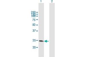 Western Blot analysis of GAMT expression in transfected 293T cell line by GAMT MaxPab polyclonal antibody. (GAMT antibody  (AA 1-236))