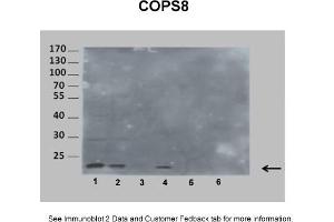 Sample Type: 1. (COPS8 antibody  (Middle Region))