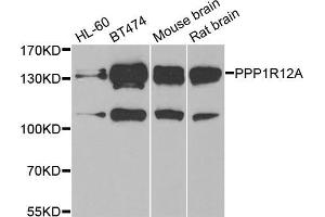 Western blot analysis of extracts of various cell lines, using PPP1R12A antibody (ABIN5974045) at 1/1000 dilution.