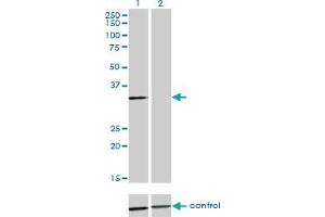 Western blot analysis of ANXA3 over-expressed 293 cell line, cotransfected with ANXA3 Validated Chimera RNAi (Lane 2) or non-transfected control (Lane 1). (Annexin A3 antibody  (AA 1-323))