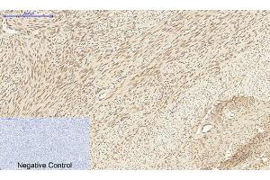 Immunohistochemical analysis of paraffin-embedded human uterus tissue.