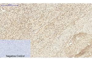 Immunohistochemical analysis of paraffin-embedded human uterus tissue. (DNMT3B antibody  (AA 1-80))