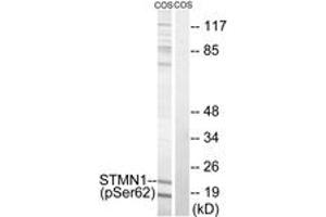 Western blot analysis of extracts from COS7 cells treated with nocodazole 1ug/ml 16h, using STMN1 (Phospho-Ser62) Antibody. (Stathmin 1 antibody  (pSer62))