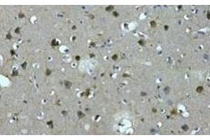 Immunohistochemistry of paraffin-embedded Human brain tissue using MAP2 Monoclonal Antibody at dilution of 1:200. (MAP2 antibody)