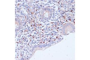 Immunohistochemistry of paraffin-embedded human appendix using WIPF1 antibody (ABIN7271348) at dilution of 1:100 (40x lens). (WIPF1 antibody  (AA 400-500))